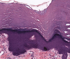 <p>How would you classify the epithelium?</p>