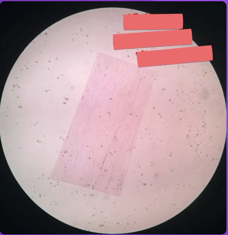 <p>What kind of tissue is this?</p>