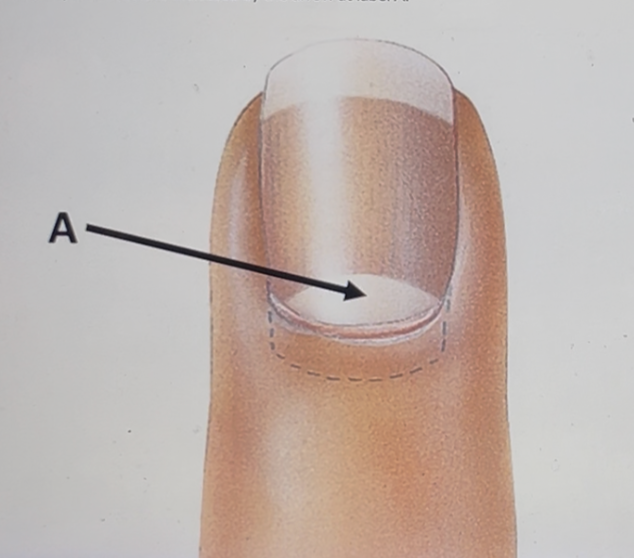 <p>Identify the structure indicated by the arrow at label A</p>