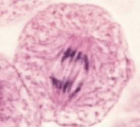<p>what phase of the cell cycle is this?</p>
