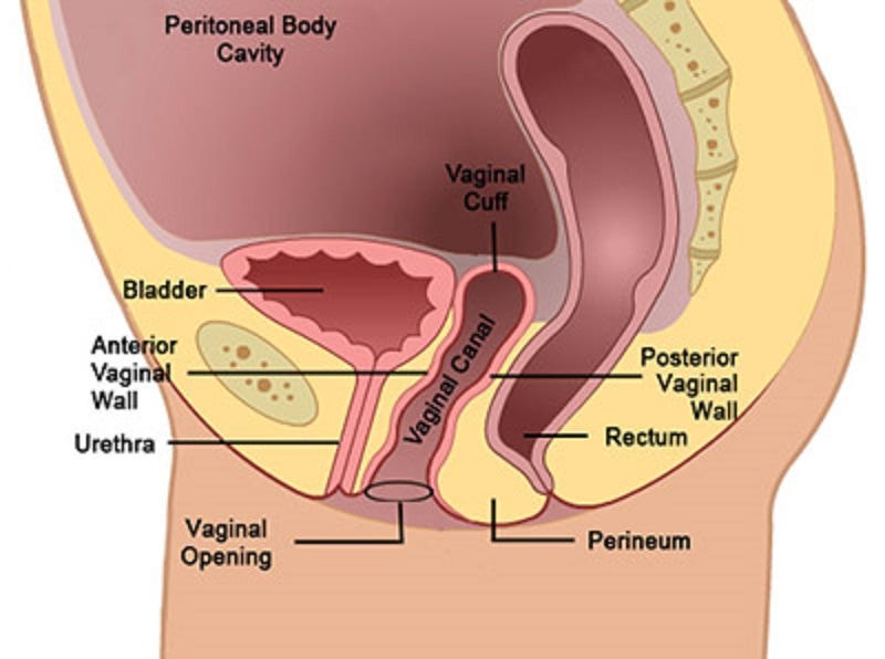 <p>Vaginal cylinder - vaginal cuff (top part left after cervix and uterus are removed)</p>