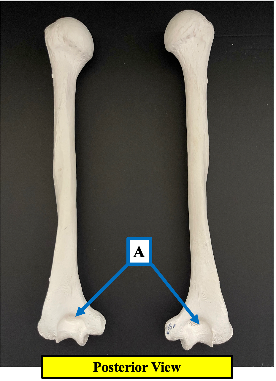 <p>Identify the name of the depression of the humerus that label <strong>A </strong>is pointing to.</p>