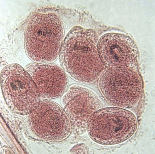 <p>What Helminth is this?</p>
