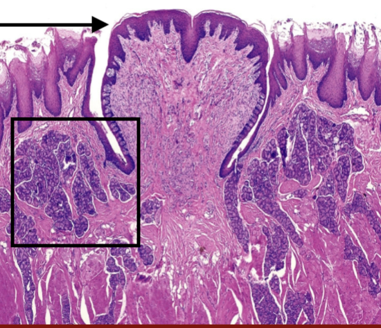 <p>What is in the box of this image of tongue?</p>