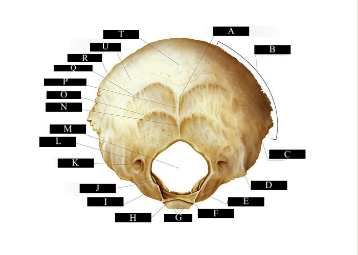 <p>Label T</p>