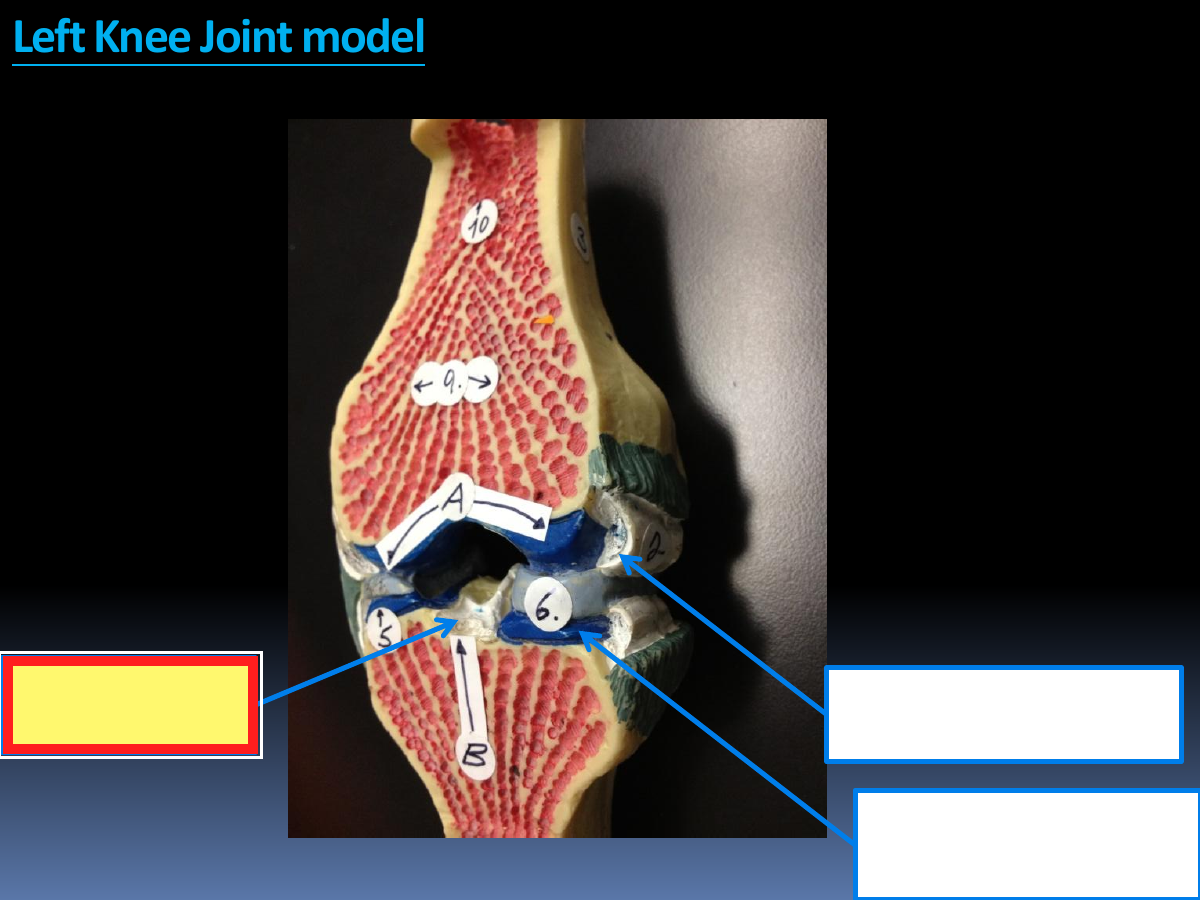 Identify the highlighted structure