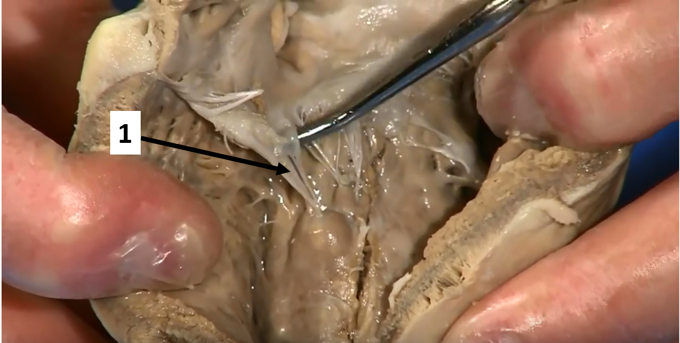 <p>What is structure #1 (strings in ventricle)?</p>