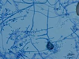 <p>more branched than rubrum, same occasional cigar-shaped macroconidia</p>