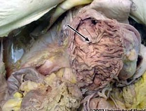 <p>what structure is being indicated to (be specfic)?</p>