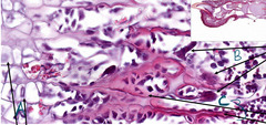 <p>What is indicated by the arrows labeled 'A' in this slide of canine claw?</p>