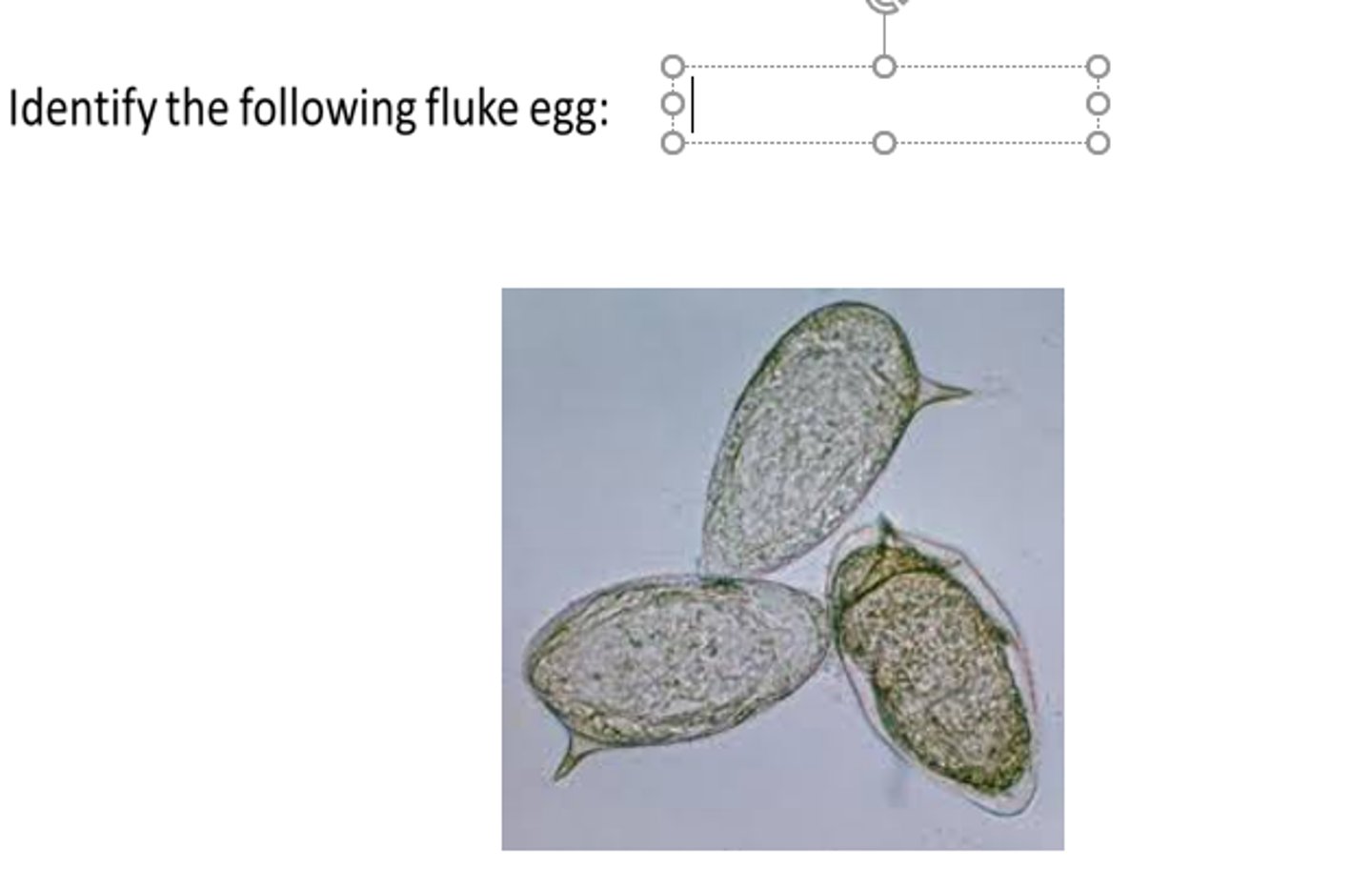 <p>What fluke egg is this?</p>
