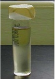 <p>Based on the growth pattern within the tube, what type of anaerobic tolerance is this microorganism?</p>