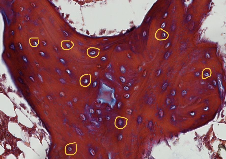 <p>ID the encircled structures in this boen spicule</p>