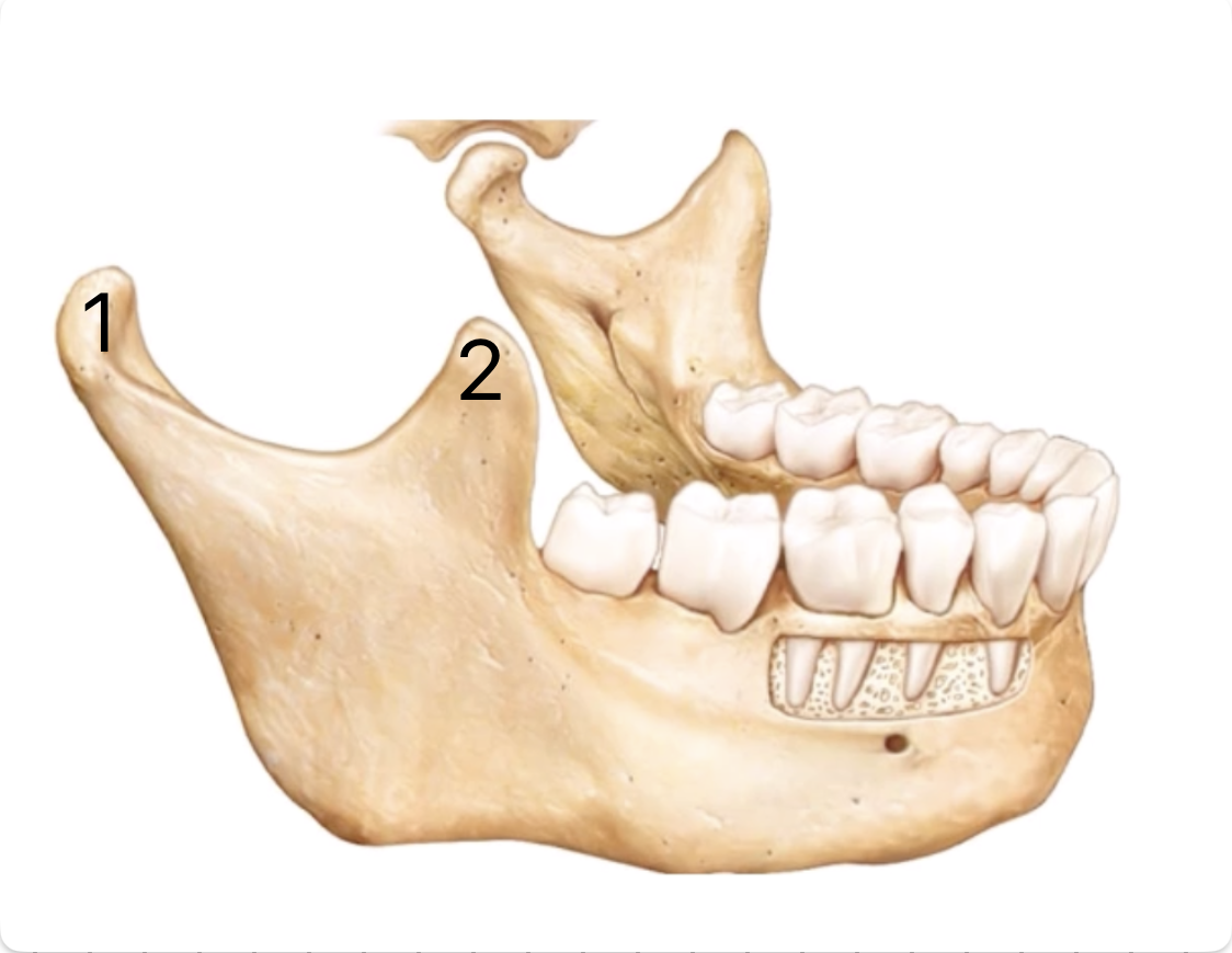 <p>Coronoid process</p>