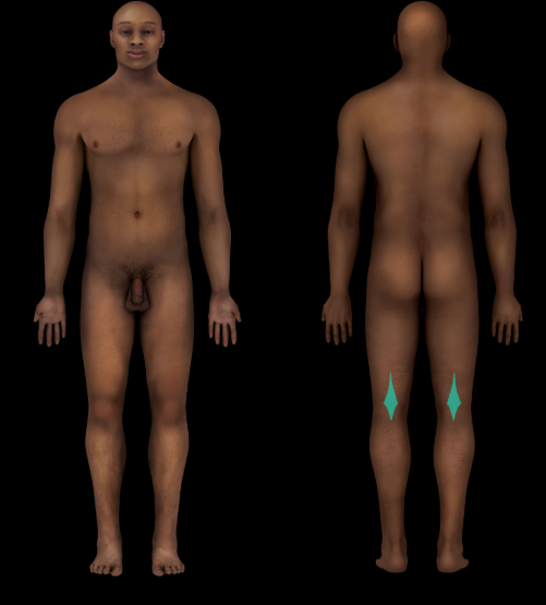 term image