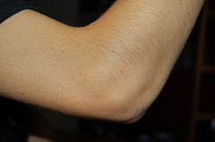 <p>elbow</p>