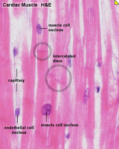 <p>Muscle tissue found only in the heart.</p>