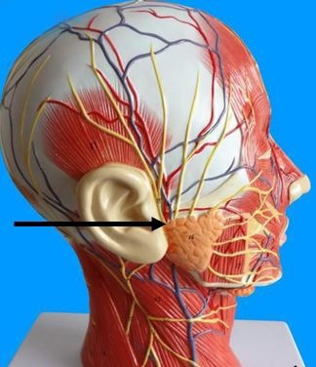 <p>Identify the name and number of this cranial nerve.</p>