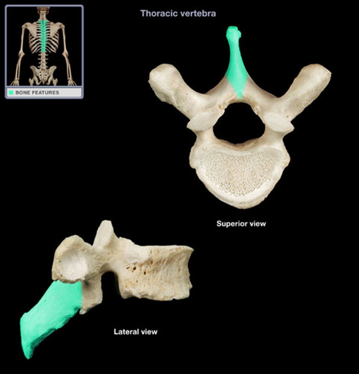 <p>lumbar vertebrae</p>