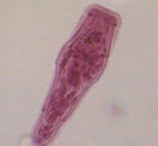 <p>What helminth/fluke/parasitic worm is this?</p>
