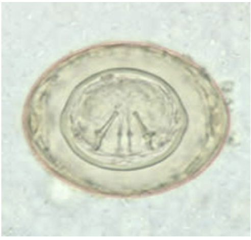 <p>-Eggs have thin inner and outer shells</p><ul><li><p>About 80 microns</p></li><li><p>Polar filaments between shells</p></li><li><p>Embryo with hooklets inside inner shell</p></li></ul><p></p>