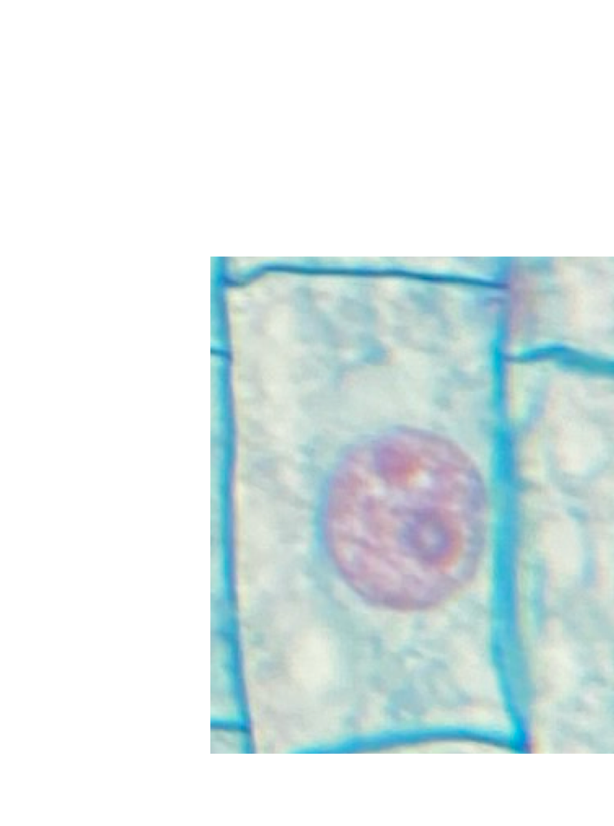 <p>What phase of mitosis is this?</p>