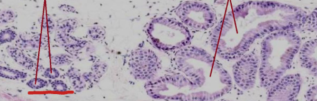 <p>Identify the gland type:</p>