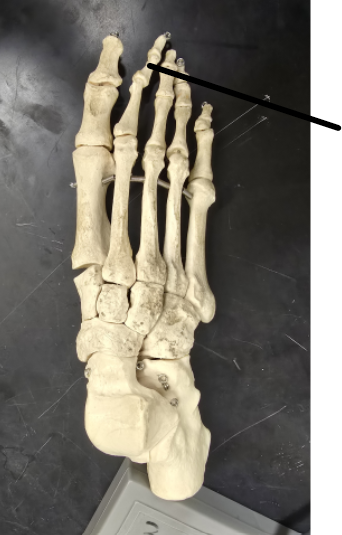 <p>Name Tarsal Bone</p>