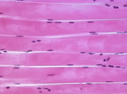 <p>Are there striations (stripes) for <u>Skeletal muscle</u>?</p>