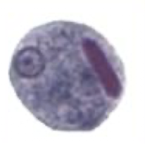 <p>What Amebae is this? Is this the trophozoite or cyst form?</p>