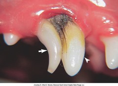 <p>retained deciduous tooth</p>