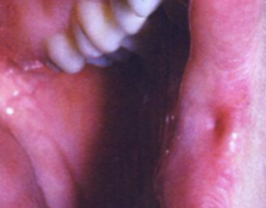 <ol start="15"><li><p>Identify the finding shown.</p></li></ol><p></p>