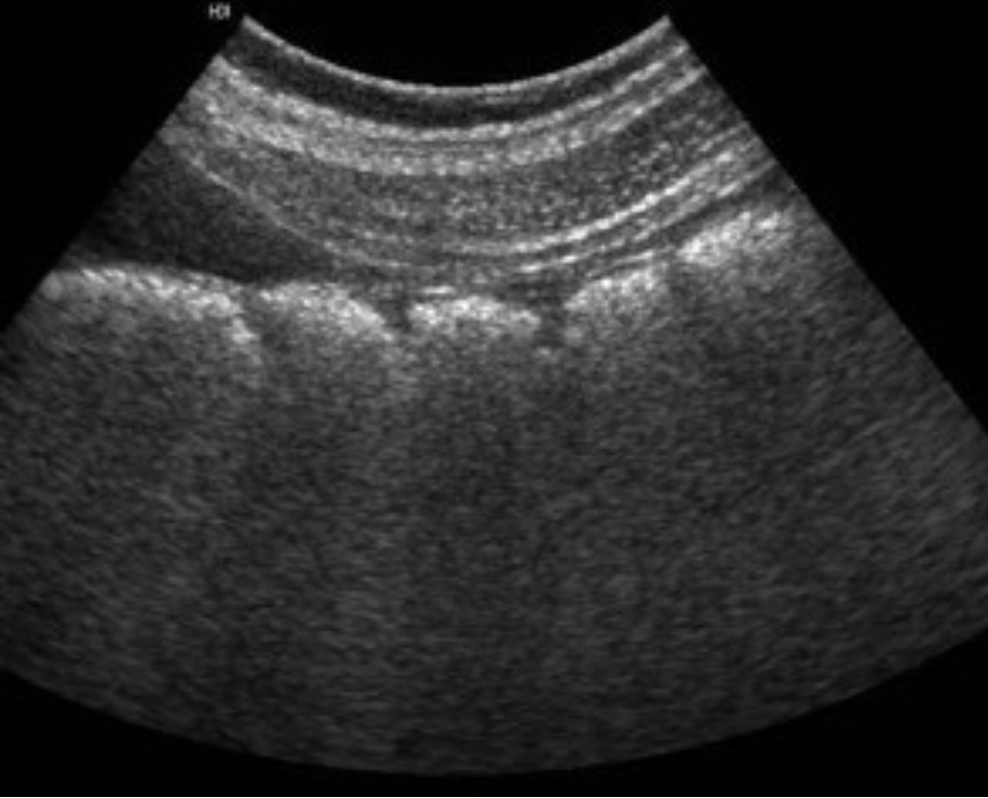 <p>What portion of the Gl tract is demonstrated on the image?</p><p>A. duodenum</p><p class="p1">B. stomach</p><p class="p1">C. esophagus</p><p class="p1">D. colon</p>