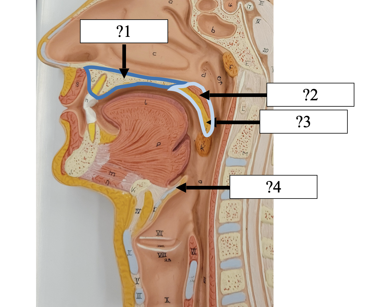 <p>1 Name the bone?</p>