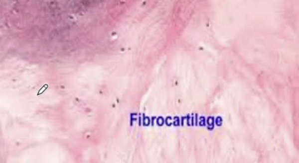 <p>What example of Fibrocartilage </p>