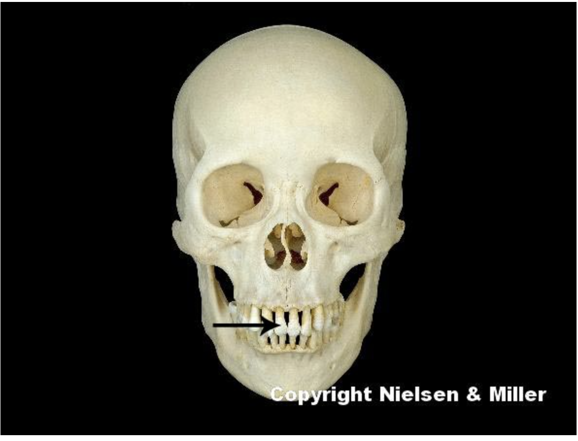 <p>the indicated tooth is an </p>