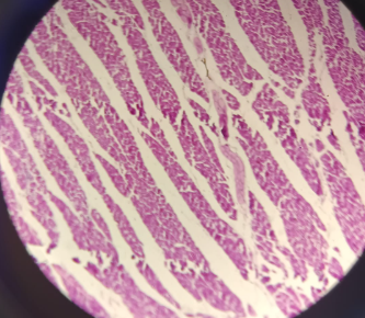 <p>Heart (cor) - HE</p><ul><li><p><strong>Cells:</strong> <strong>Cardiomyocytes</strong>; typically a single-nucleus cell.</p></li><li><p><strong>Organization:</strong> Each cell is wrapped in its own <strong>endomysium</strong>.</p></li><li><p><strong>Connections:</strong> Linked by <strong>intercalated discs</strong>.</p></li><li><p><strong>Conducting System:</strong> Large <strong>conducting cells</strong> (Purkinje fibers) that are <strong>not red</strong> because they <strong>lack myofibrils</strong>.</p></li><li><p><strong>Endocrine Cells:</strong> Produce <strong>atrial natriuretic factor</strong> to control blood pressure/kidneys</p></li></ul><p></p>