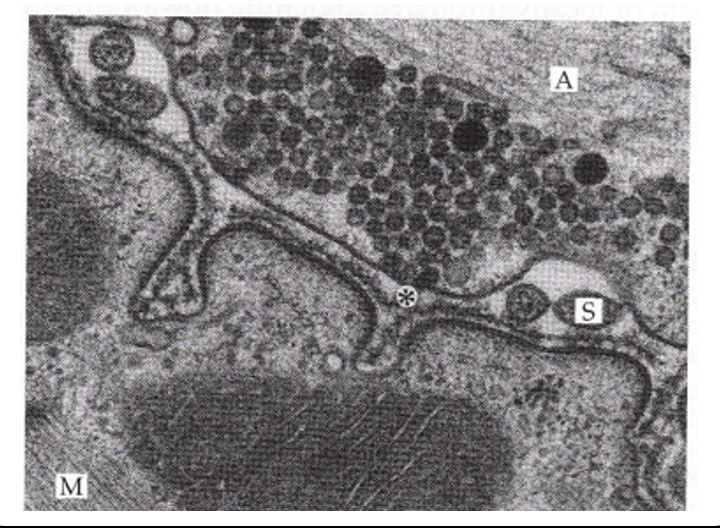 <p>basal lamina is positioned in the synaptic cleft: fuzzy structure formed from the ectodermal and mesodermal germ layer interactions</p>