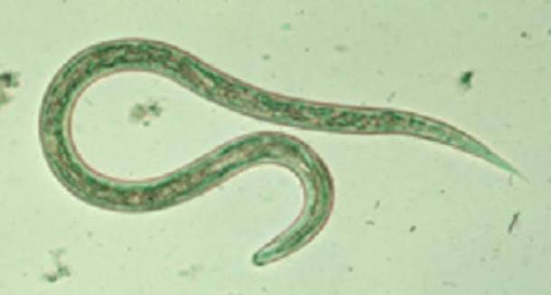 <p>• <strong>”ladder-like”</strong> appearance </p><p>• May be confused with <strong>helminth larva </strong>because of shape and size </p><p>• Lacks <strong>head or tail region</strong></p><p></p><p></p>