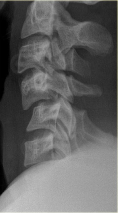 <p>What is the finding/sign and what is the diagnosis?</p>