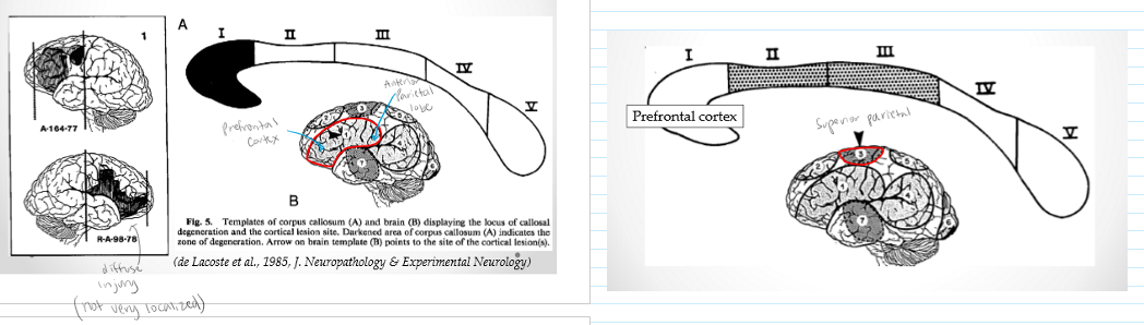 <p>Rostrum and genu. Prefrontal area</p>