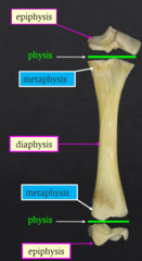 <p>Proximal/distal epiphysis, proximal/distal metaphysis, diaphysis, and physis</p>