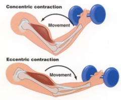 <p>An eccentric contraction occurs when the muscle contracts while lengthening.</p>