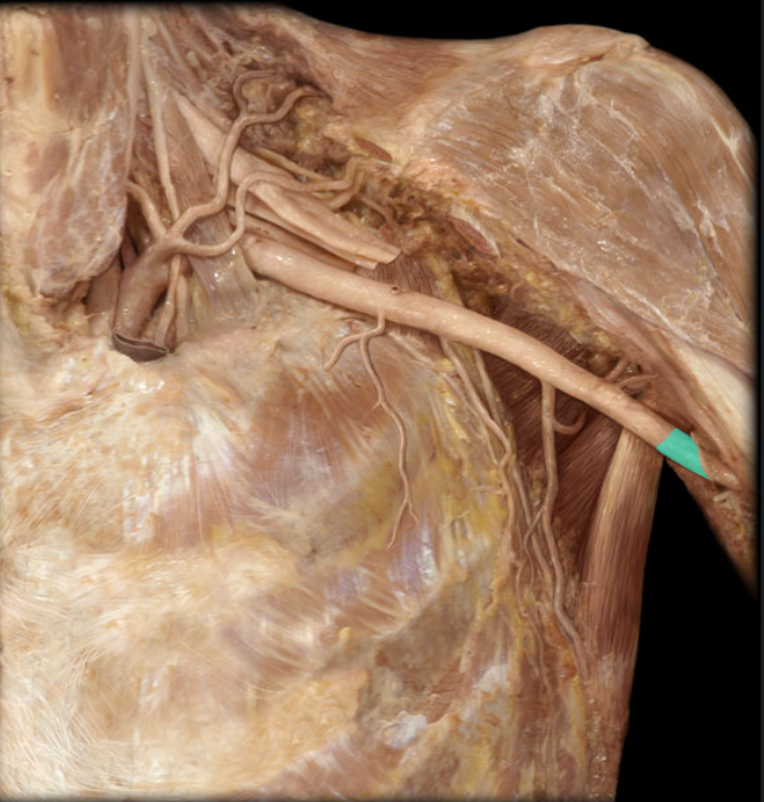 <ul><li><p><strong>Origin: </strong>Axillary (at inferior border of teres major m.)</p></li><li><p><strong>Course: </strong>Passes inferiorly along medial aspect of arm</p></li><li><p><strong>Distribution: </strong>Arm muscles, Humerus, and Elbow joint</p></li><li><p><strong>Branches:</strong></p><ul><li><p>Deep brachial (deep artery of the arm, or profound brachii a.)</p></li><li><p>Superior ulnar collateral</p></li><li><p>Inferior ulnar collateral</p></li><li><p>Radial</p></li><li><p>Ulnar</p></li></ul></li><li><p><strong>Comment:</strong></p><ul><li><p>Large arteries do not by themselves supply structures, but do so through their branches</p></li></ul></li></ul><p></p>