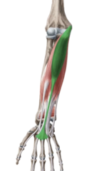 <p>common flexor tendon at medial epicondyle of humerus</p>