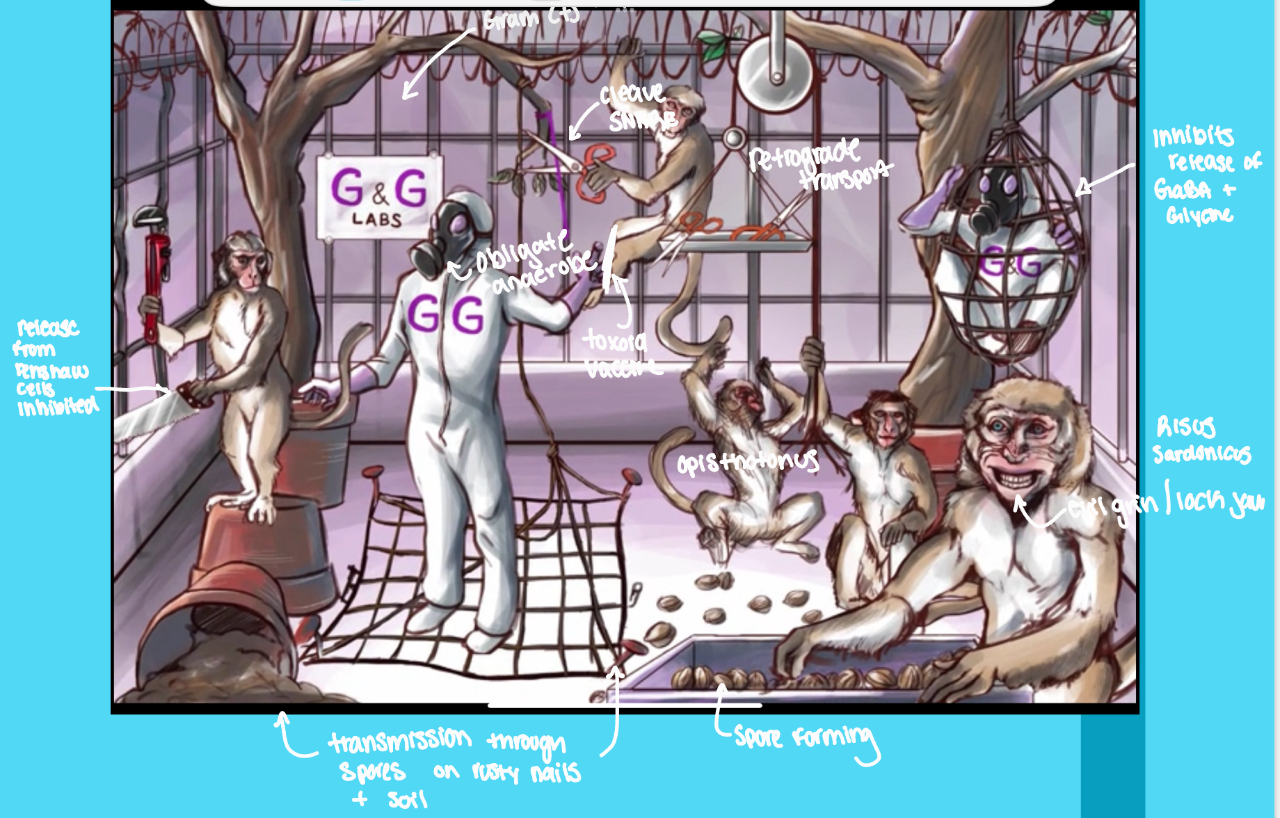 <p><span><span>Type of paralysis?</span></span></p>