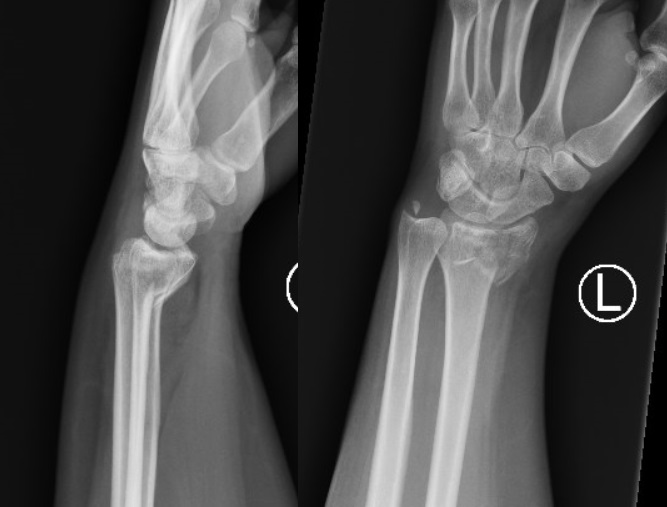 <p>What kind of fx is this?</p>