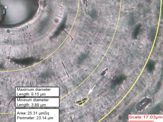 <p>ID Structure (yellow cross in it)</p>