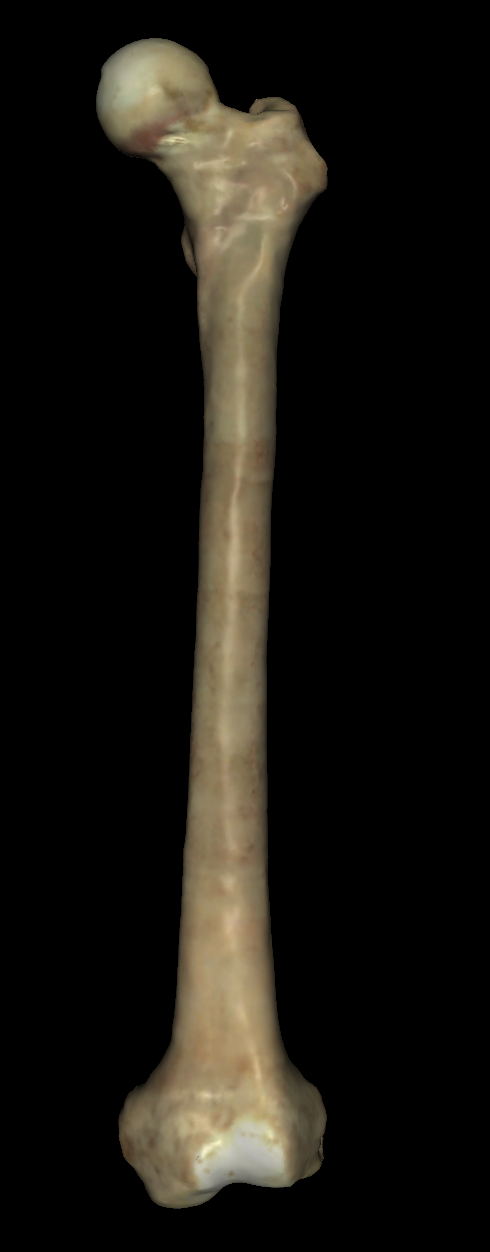 <p>is this the left or right femur? (anterior view)</p>