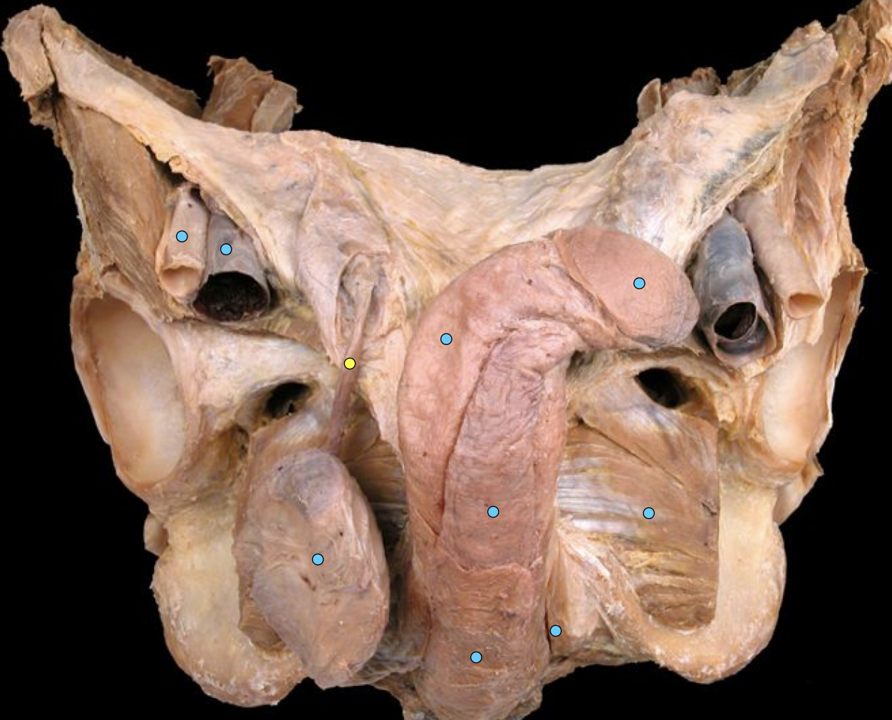 knowt flashcard image